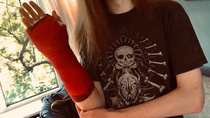 Langsommelighed og tålmodighed er det nye sort. (man kan jo ligesom ikke bare råbe af en nerve og bede den skynde sig lidt mere med at vokse sammen, vel?&nbsp;)